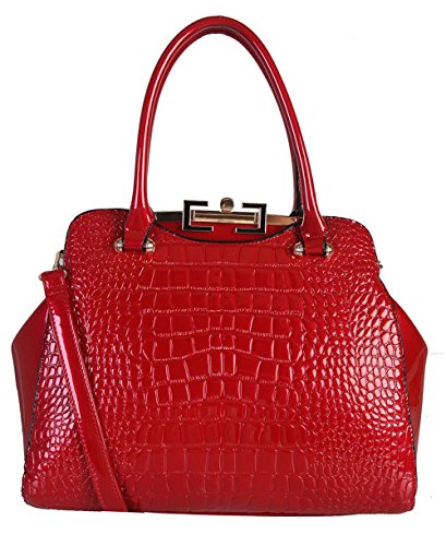 Rimen & Co. Large Shiny Patent Animal Print Doctor Woman Handbag With Gold Metal Clasp Closure And Removable Strap LP-2460